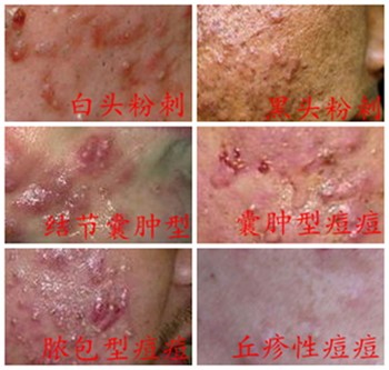 长春肤康医院