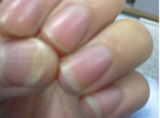上海皮肤病医院