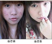长春肤康医院