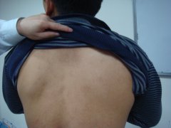 长春肤康医院 白癜风