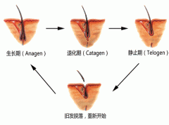 脱发患者朋友的病因图