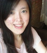 青春痘患者