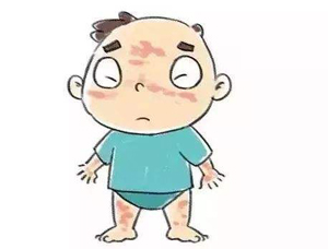 怎样区分终究是不是白癜风?