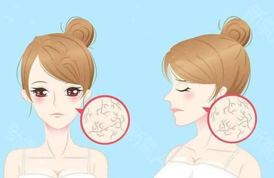 什么是肌肤“假性”过敏?
