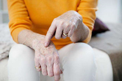 中老年常见皮肤疾病及应对方式