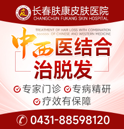 长春脱发医院如何判断脂溢性脱发