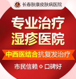 长春皮肤病专科医院-湿疹治疗能除根吗